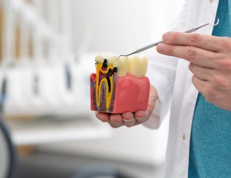 What to Expect Before, During, and After a Root Canal