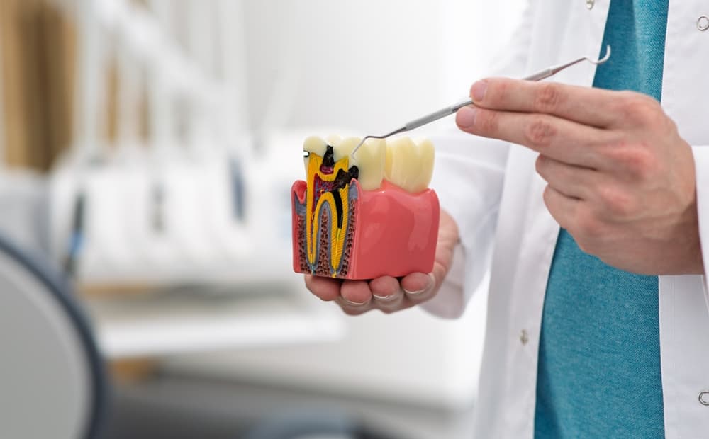 root canal procedures